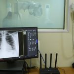 brasil-tem-aumento-de-hospitalizacoes-por-influenza-a,-alerta-fiocruz